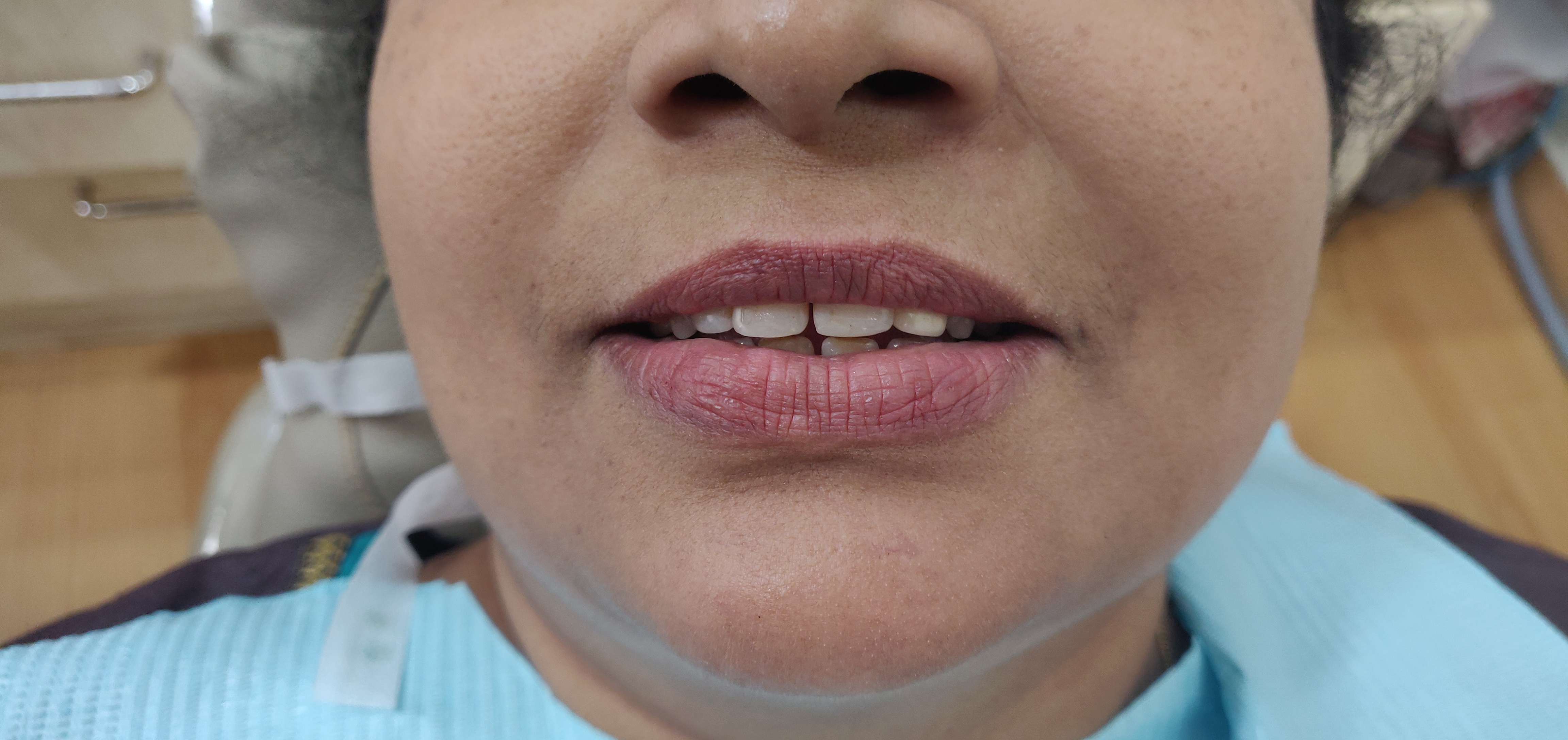 Aspen Dental Care - Dr Pramod Kumar